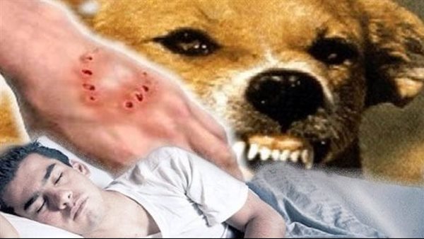 تفسير حلم عض الكلاب