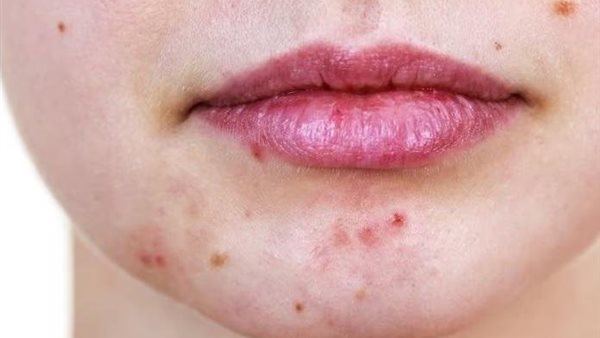  صورة تعبيرية 