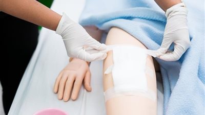 لماذا تستمر الجروح المزمنة دون التئام؟.. أطباء يوضحون الأسباب والعلاج