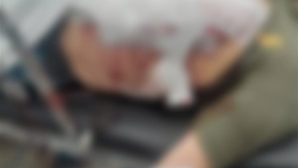 المجني عليه