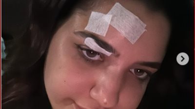 كنزي مدبولي تغادر المستشفى بعد تعرضها لحادث سير