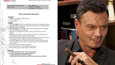 بسبب حادث الشيخ زايد.. عباس أبو الحسن يجري عملية جراحية في وتر أكيلس اليوم