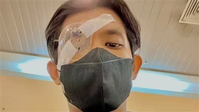 بسبب فرك عينيه.. شاب يخضع لـ عملية زرع قرنية