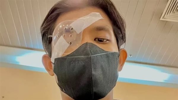 عملية زرع قرنية