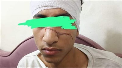 بسبب كيس مياه.. عاطل يشوه وجه رجل ونجله بسلاح أبيض والأمن يضبط المتهم