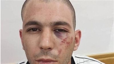 رسموا نجمة داوود على وجهه.. محاكمة 7 ضباط إسرائيليين بسبب تعذيب أسير فلسطيني أثناء اعتقاله