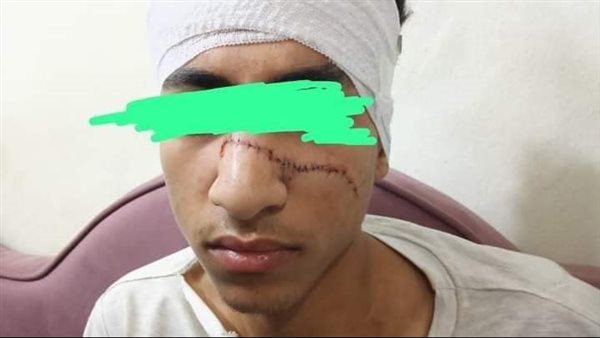 المجني عليه 