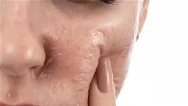  صورة تعبيرية 