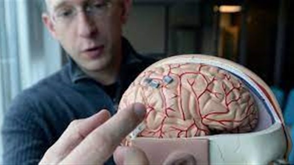 شرائح الدماغ