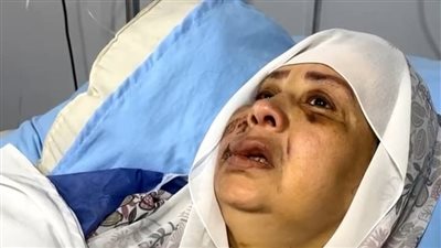 حق اللي ماتت قبل حقي.. الضحية الثانية في حادث عباس أبو الحسن: إحنا ناس غلابة ليه عملت فينا كده؟