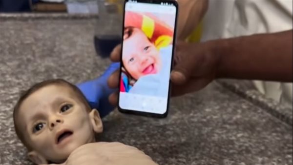 الرضيع فايز أبو عطايا