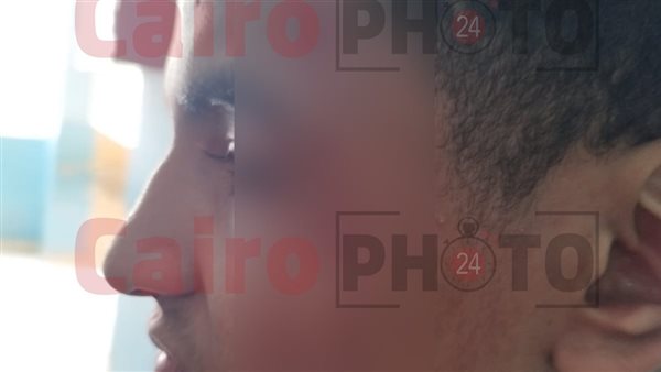 الطالب المصاب