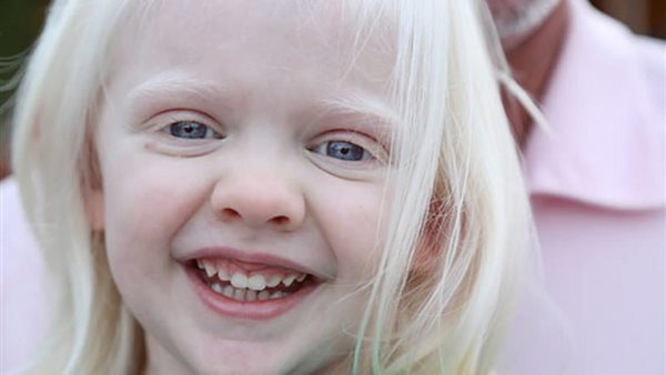 اليوم العالمي للتوعية