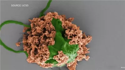 علماء يتوصلون لروبوتات صغيرة تقلص أورام سرطان الرئة 