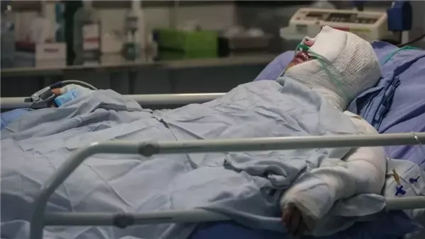 مصاب - تعبيرية 