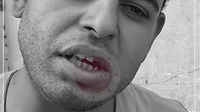 عملية جراحية للزوجة وعلاج مكثف للأم.. لجنة صحية تفحص حالة بائع غزل البنات وأسرته