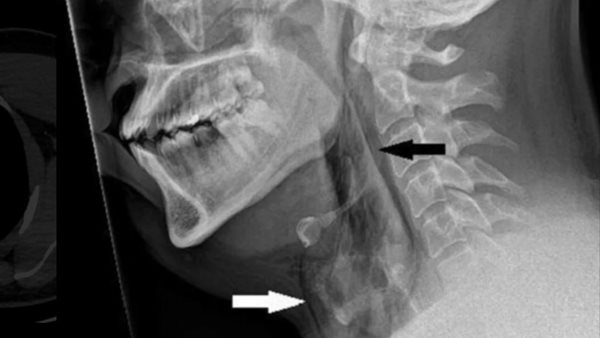 رجل أسكتلندي تعرض