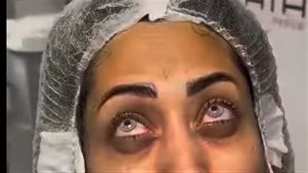 تغيير لون العين 