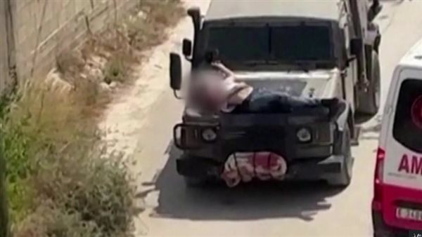 ربط جريح فلسطيني