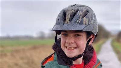 بعد تركيبه لأول مرة في العالم.. كيف يعمل التحفيز الكهربي على تقليل نوبات الصرع؟