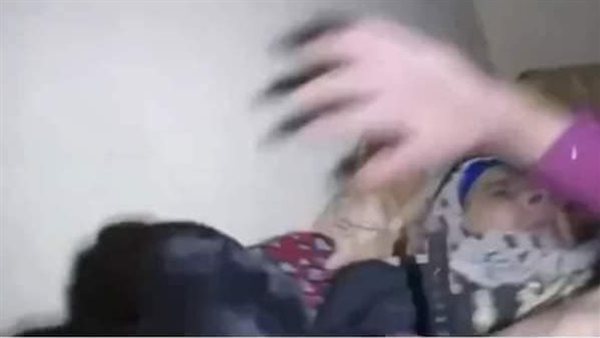 اعتداء الكلب على