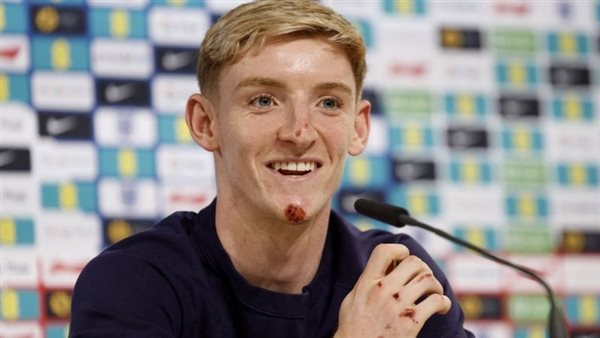 أنتوني جوردون