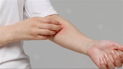 أشياء لا تعرفها قد تسبب حساسية لديك.. احذر منها