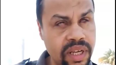 عامل فقد بصره خلال إصلاحه لحوض منزله يستغيث: محتاج عملية تكلفتها 350 آلف جنيه| بث مباشر 