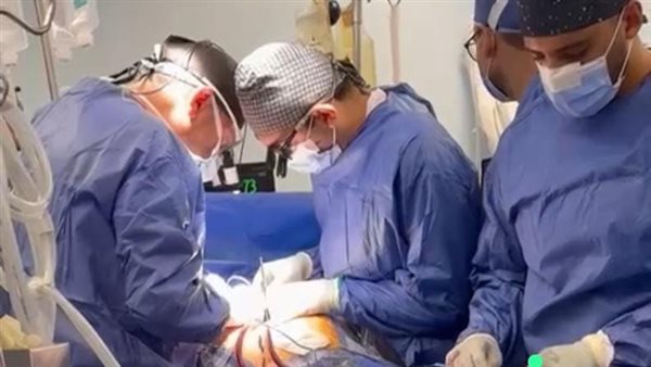 جانب من العملية 