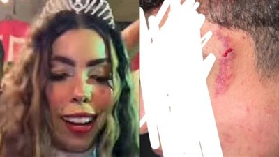 سيف عشماوي المتهم في واقعة عيد ميلاد مريم الحركي يرد على الاتهامات الموجه له: كانوا شاربين ومش في وعيهم 