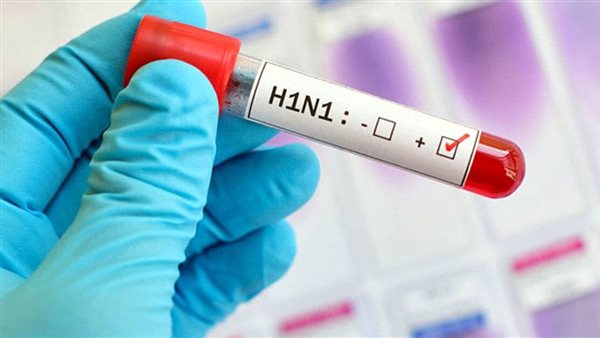 الإنفلونزا 