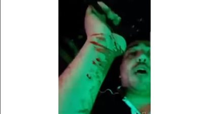 بلوجر يعتدي على آخر بسلاح أبيض في رأس البر | صور 