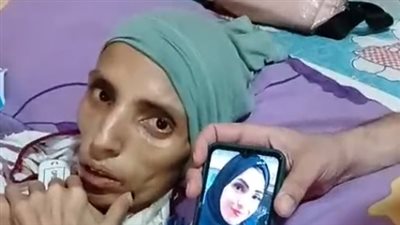 الإهمال الطبي أصابها بالسرطان.. زوج يستغيث لعلاج زوجته: كانت بتعمل عملية واستخدموا أدوات مش معقمة| بث مباشر
