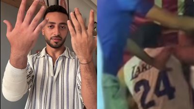  البلوجر حسن بيسو المعتدى عليه في عيد ميلاد مريم الحركي: واحد جه خبط فيا افتكرته متسول 