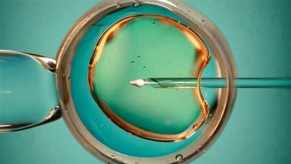  صورة تعبيرية 