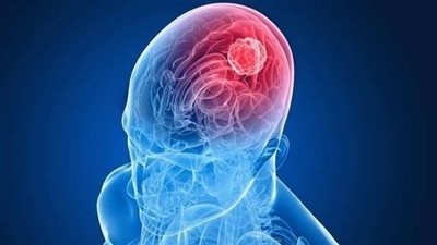 دراسة تكشف عن ارتباطات جديدة بين الهواتف الذكية وأورام الدماغ
