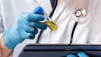 دراسة: اختبار بول جديد غير الجراحي يساعد في الكشف عن سرطان عنق الرحم