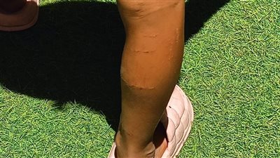 بعد اتهامات بتعذيب الصغار.. مديرة دار أيتام بالهرم: الجروح بسبب لسعة قنديل البحر