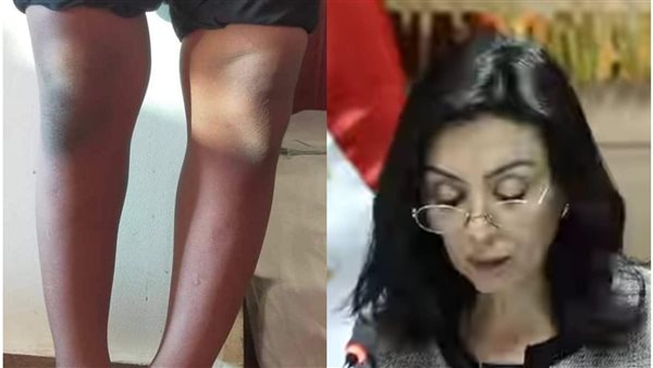 وزيرة التضامن تتدخل