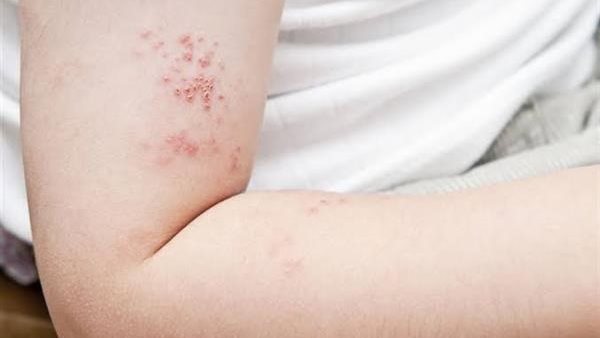 الحزام الناري 