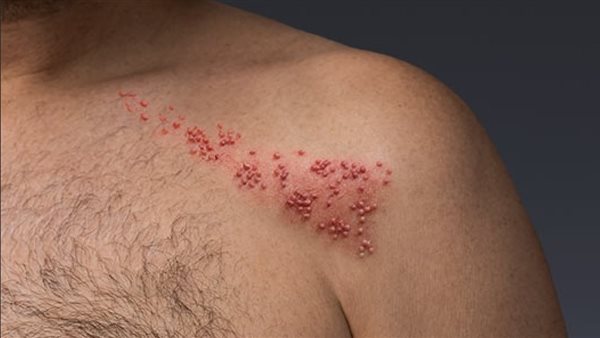  الحزام الناري