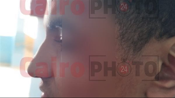 المجني عليه 