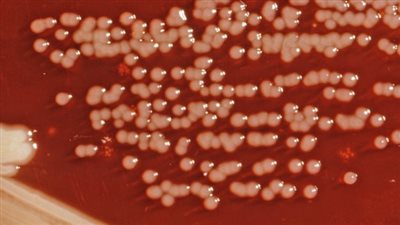 تفشي عدوى طفيلية تنتقل عن طريق الغذاء ببعض الدول الأوروبية