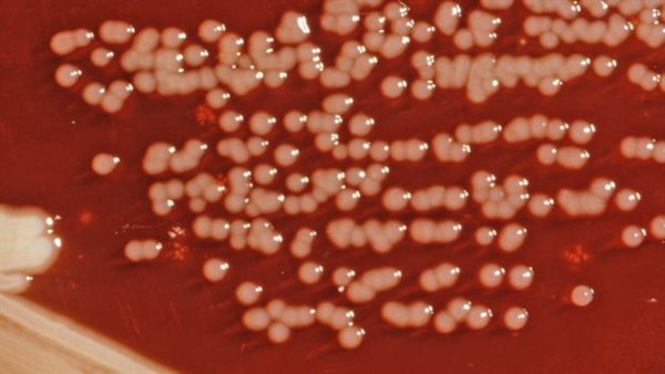 طفيل يرسينيا إنتينكوليتيكا