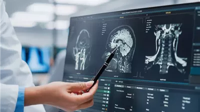 الإفراط في تناول لحم البقر يزيد من نسبة التدهور المعرفي|دراسة