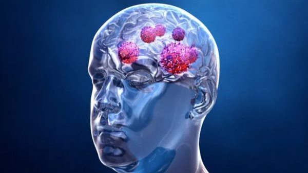 سرطان الرأس