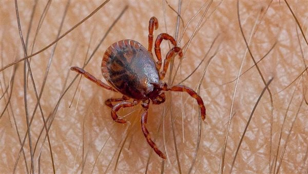  فيروس حمى القرم