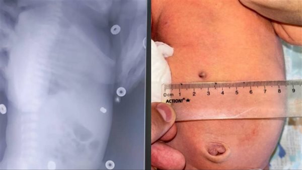 ولادة رضيعة روسية