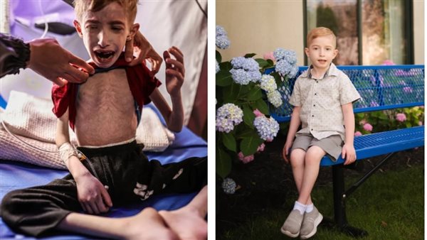 الطفل الفلسطيني فادي