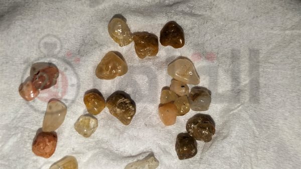 الحجارة المستخرجة